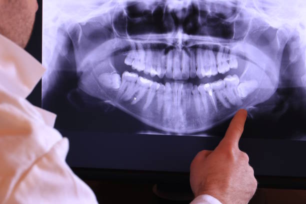 Best Emergency Denture Repair in Woodsboro, TX