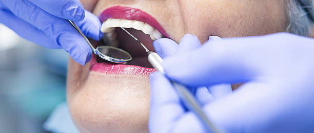 Best Emergency Root Canal Treatment in Woodsboro, TX